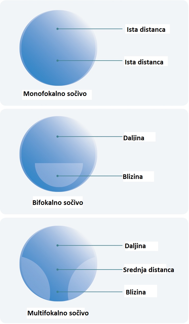 Monofokalno sočivo, bifokalno sočivo i multifokalno sočivo