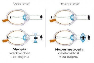 Naočare za daljinu i blizinu